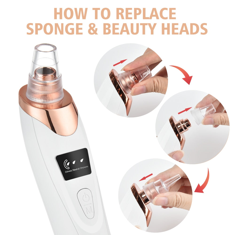 Electric Blackhead Remover for smooth, clear skin