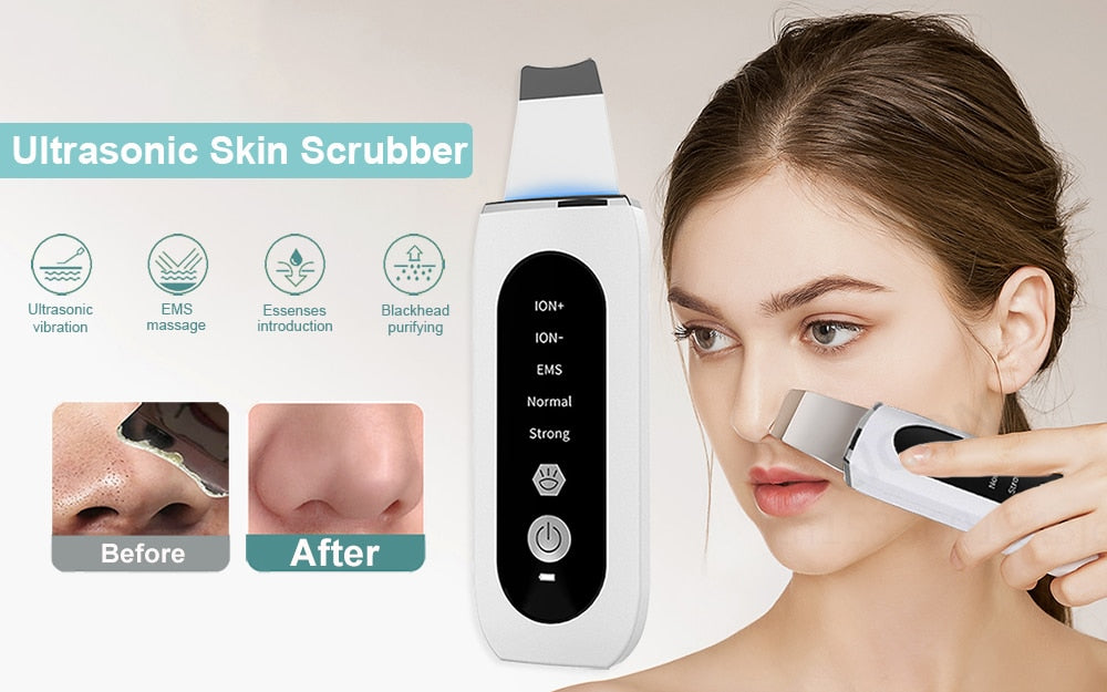 Ultrasonic Skin Scrubber Peeling Blackhead Remover