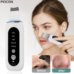 Ultrasonic Skin Scrubber Peeling Blackhead Remover