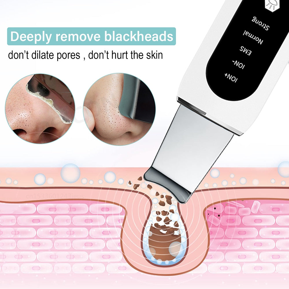 Ultrasonic Skin Scrubber Peeling Blackhead Remover