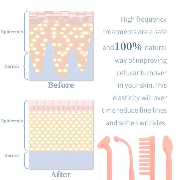 Portable Handheld High Frequency Skin Therapy Wand